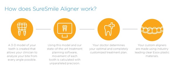 SureSmile Process