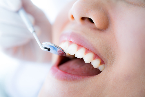 close-up of female patient having her teeth examined